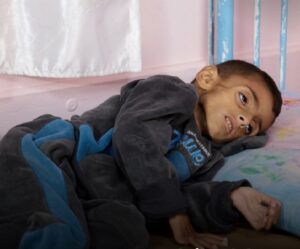 দুর্ভিক্ষের কবলে গাজা