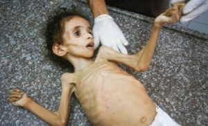 আমরা যেভাবে গাজার দুর্ভিক্ষ বন্ধ করতে পারি