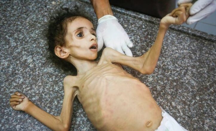 আমরা যেভাবে গাজার দুর্ভিক্ষ বন্ধ করতে পারি